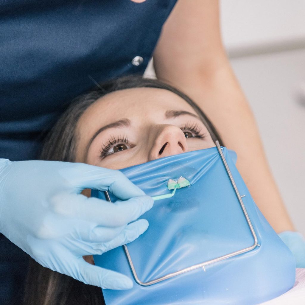 How to repair damaged teeth? 17/07/2020 How to repair damaged teeth - Veneers