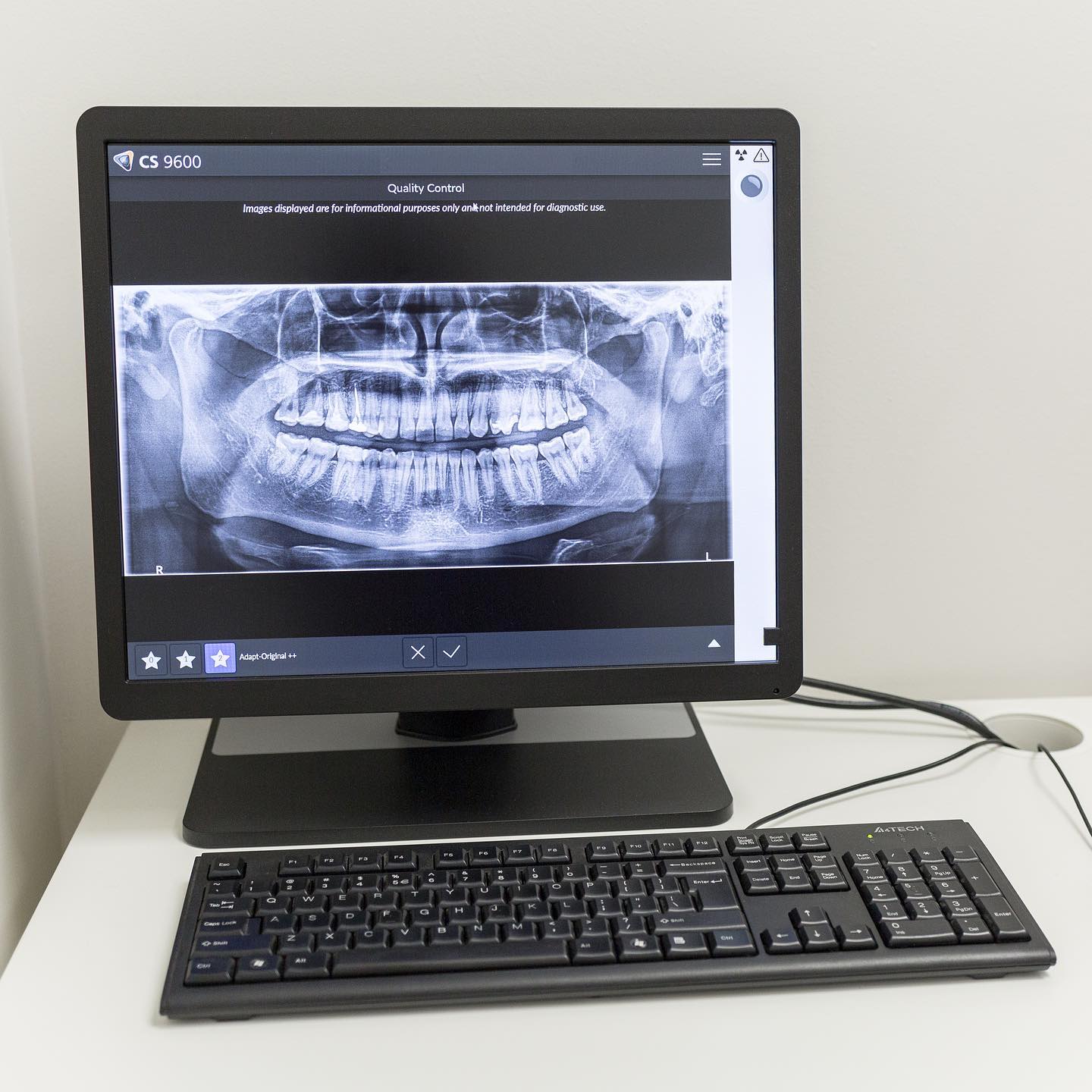 RVG: Periapical X-ray 12/07/2022 X-ray Image