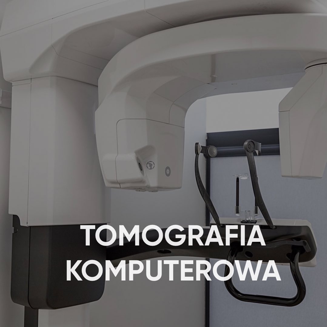 CBCT 16x 10: Dental, ENT Tomography | CBCT 12/07/2022 ENT CBCT Tomography