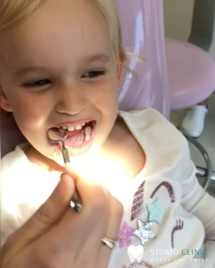 Malocclusion in children - orthodontic treatment for children 17/12/2024 Stomo Clinic Wrocław Dentysta Ortodonta Implanty malocclusion in children 1