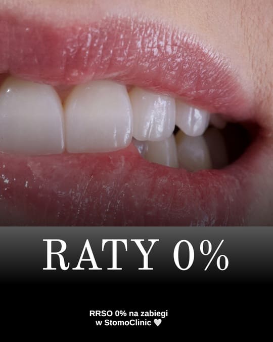 Ile kosztuje Invisalign we Wrocławiu? Kompletny przewodnik 23/01/2025 Stomo Clinic Wrocław Dentysta Ortodonta Implanty Ile kosztuje Invisalign 1