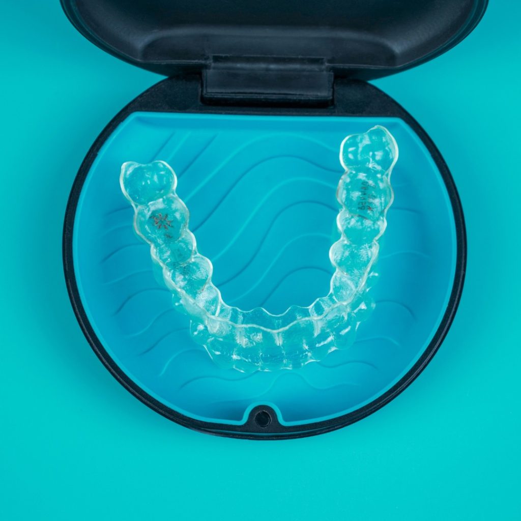 Orthodontic braces - 5 things you need to know before treatment 17/02/2025 Orthodontic braces - what should you know before treatment?