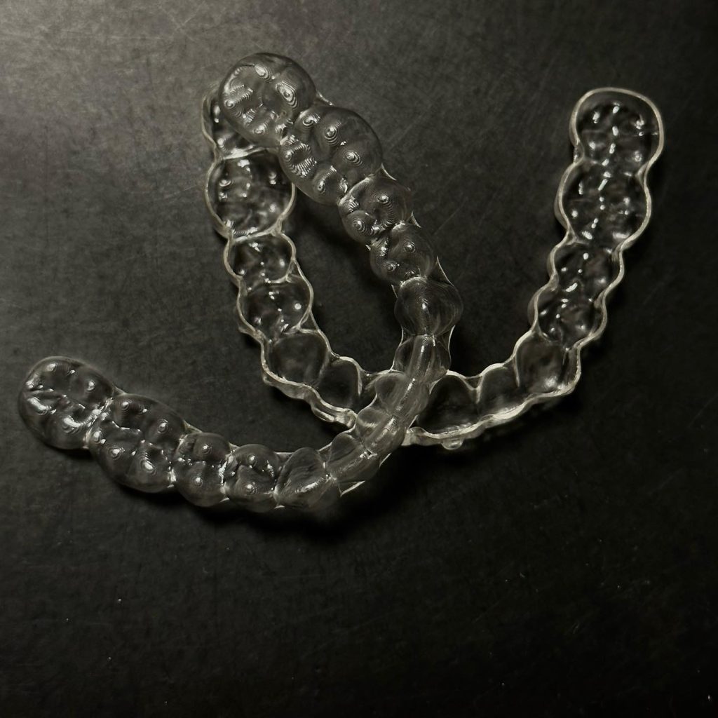 Orthodontic braces - 5 things you need to know before treatment 17/02/2025 invisible braces