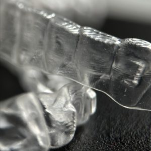 Spark Clear Aligners - Leczenie ortodontyczne nakładkami dorosłych 12/02/2025 niewidoczny aparat ortodontyczny dla dorosłych wrocław wrocław