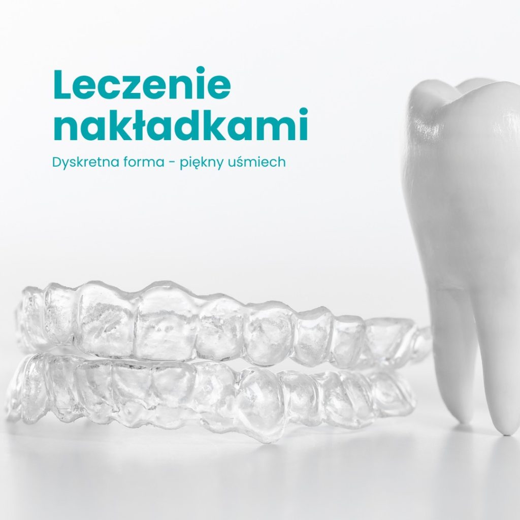 Do teeth straightening aligners work? 21/09/2022 straightening aligners
