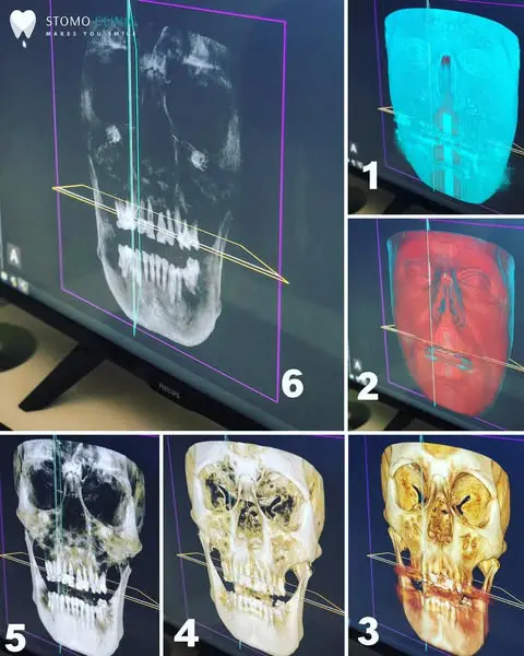 Diagnosis of the temporomandibular joint 21/05/2025 Diagnosis of the articular-mandibular joint in-roclaw