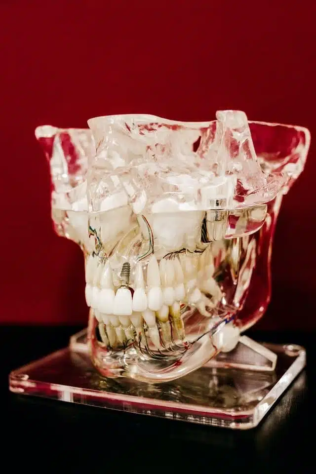 Diagnosis of the temporomandibular joint 21/05/2025 diagnosis of the temporomandibular joint