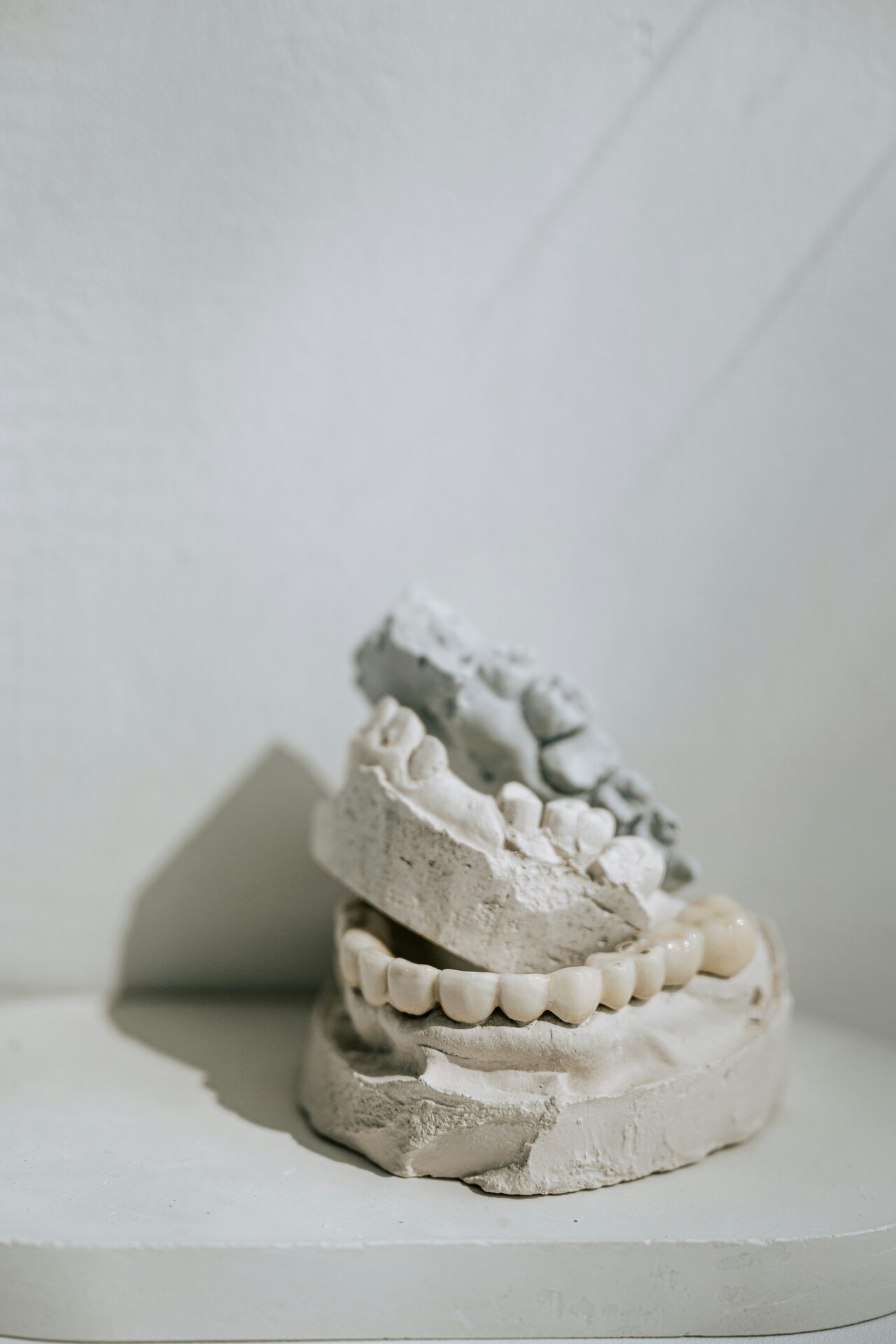 Implants 13/11/2020 Dental implants Wroclaw durability for decades