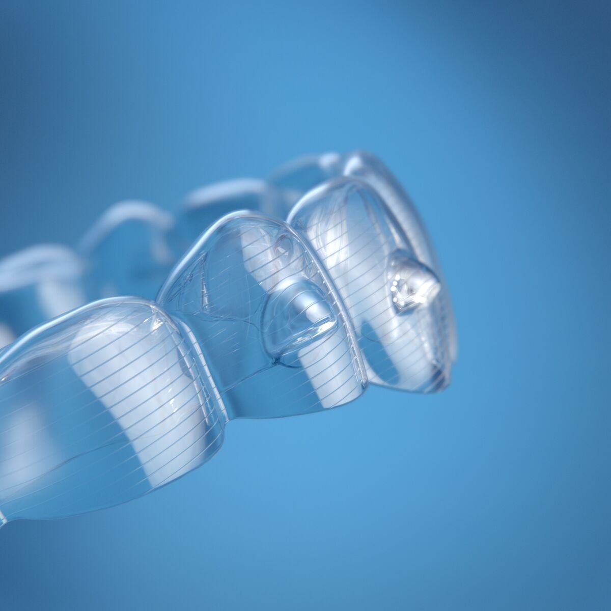 Invisalign Vivera 13/03/2026 Invisalign Vivera Wrocław