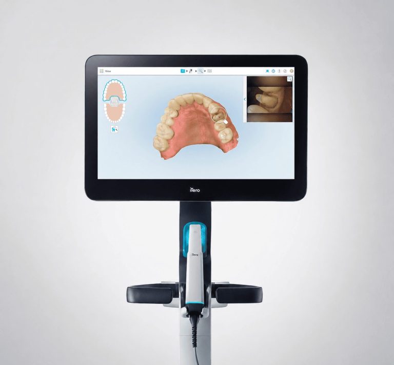intraoral scanner itero lumina wroclaw