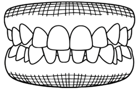 Invisalign Wrocław – przezroczyste nakładki ortodontyczne 04/04/2026 nadzgryz pionowy wrocław